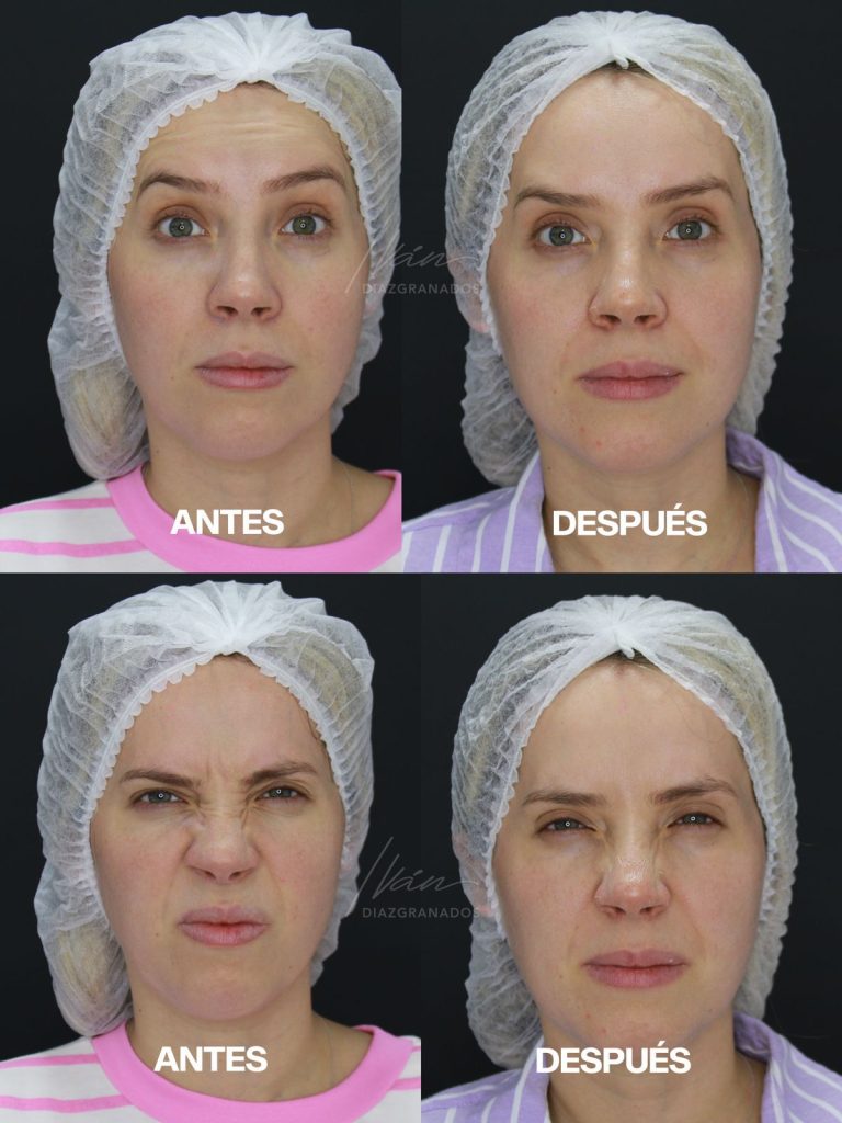 Testimonio dermatología