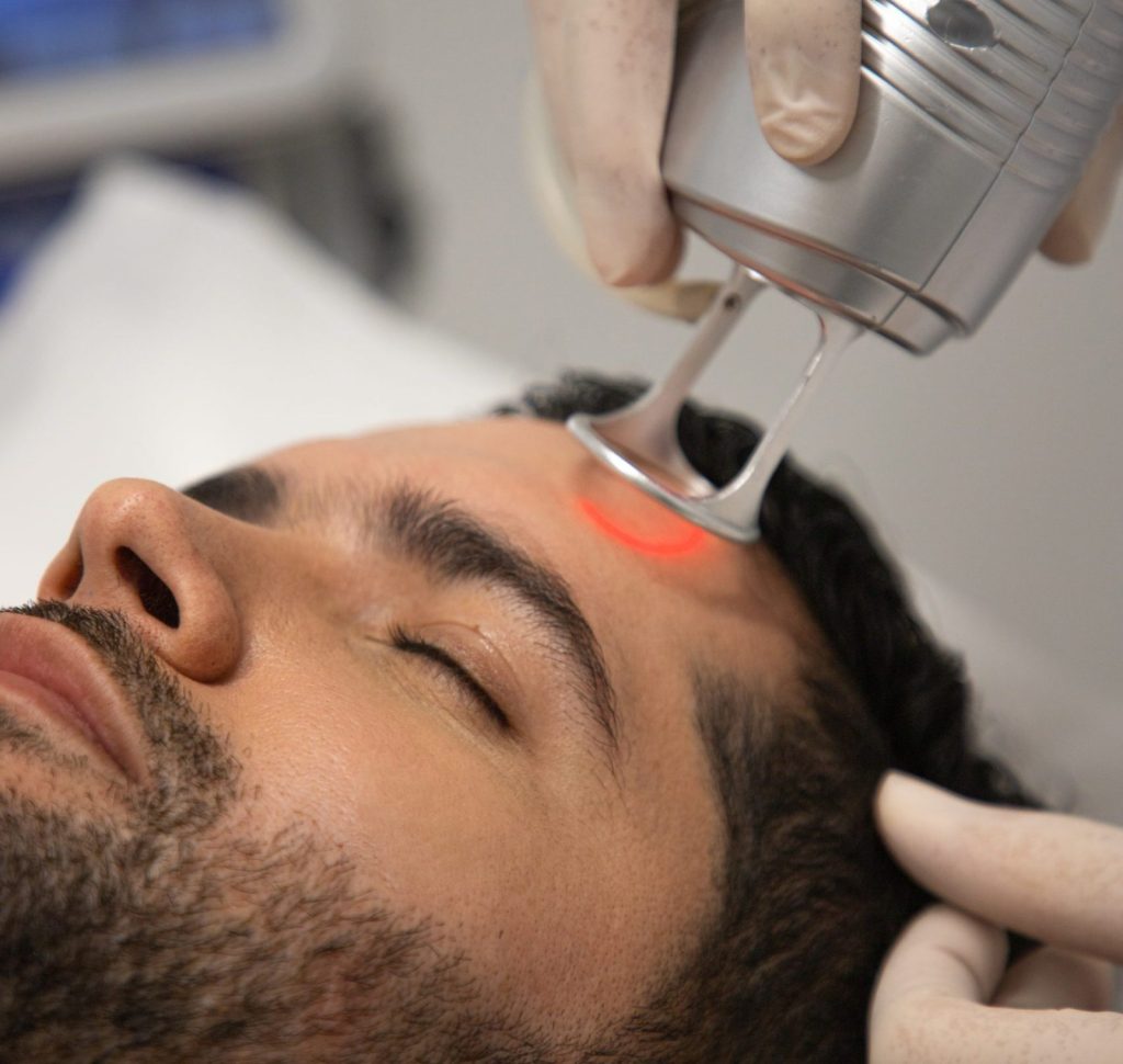 Laser CO2 fraccionado